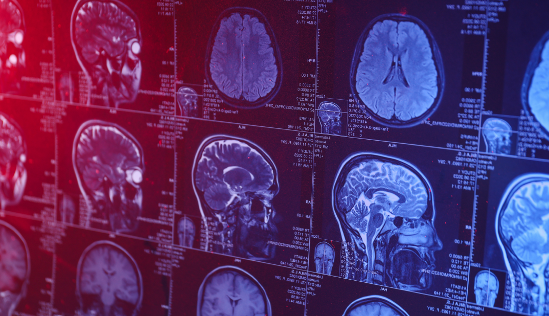 Machine learning in the database